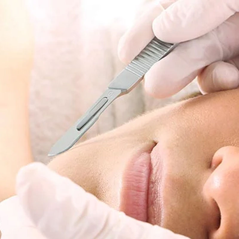 dermaplaning in Crowborough